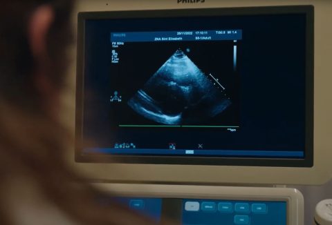Cardiogram