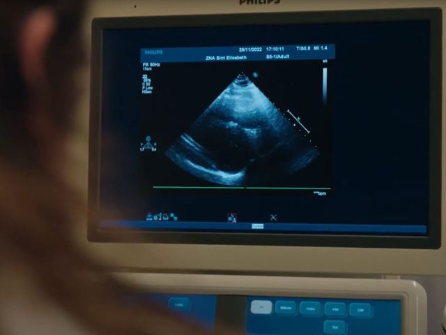 Cardiogram